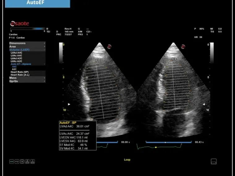 Ultrasonograf MyLab™X6