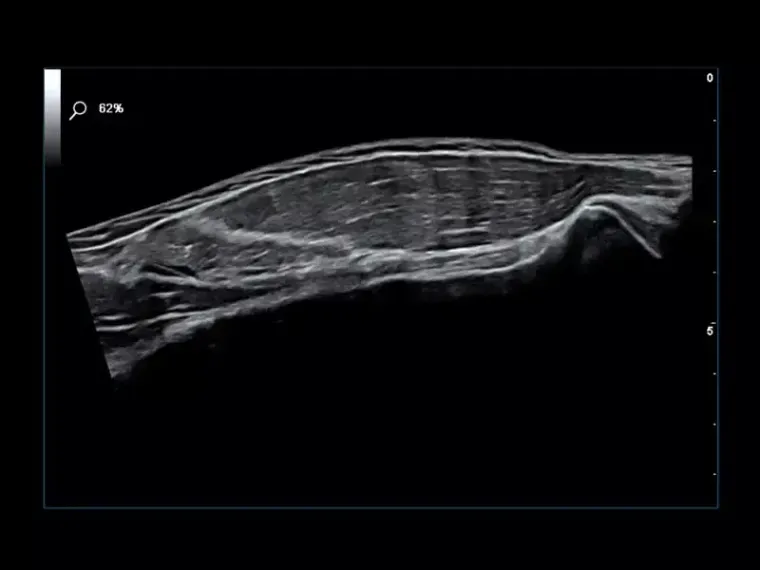 Aparat usg przenośny | MyLab™Omega