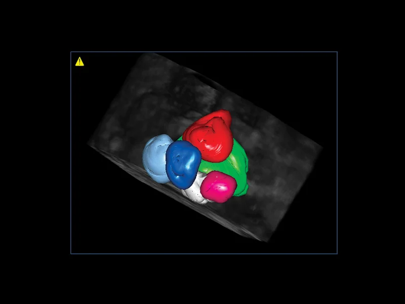 Gynaecology clinical image