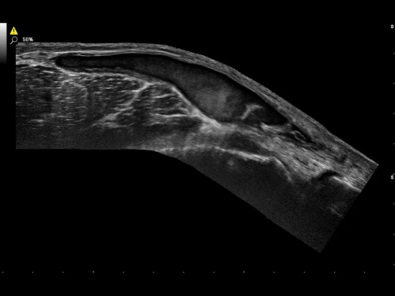 Musculoskeletal Clinical Images