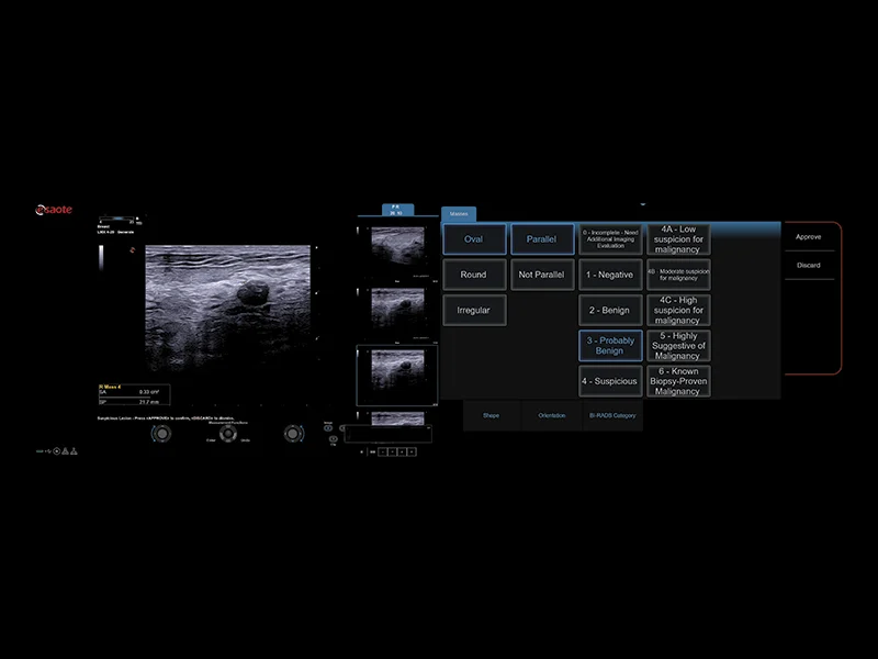 Breast clinical image