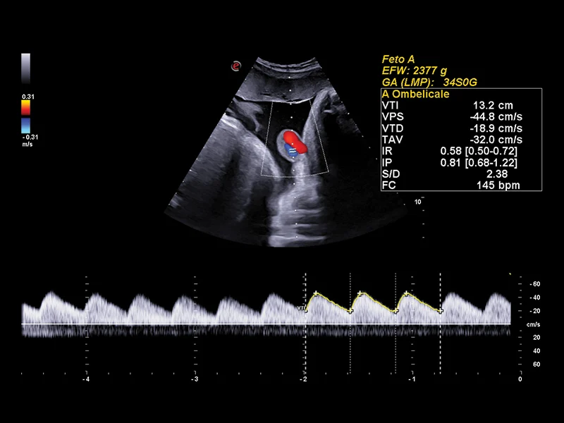 Obstetrics clinical image