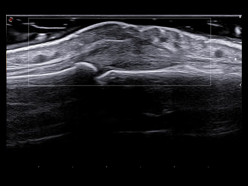 Rheumatology clinical Images