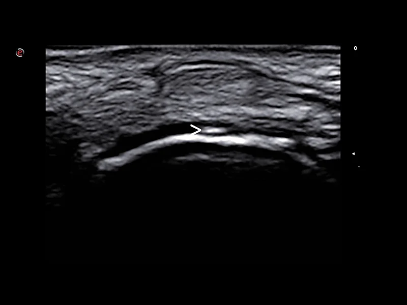 Rheumatology clinical Images