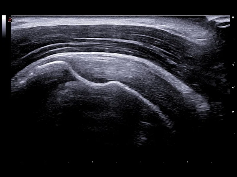 Rheumatology clinical Images