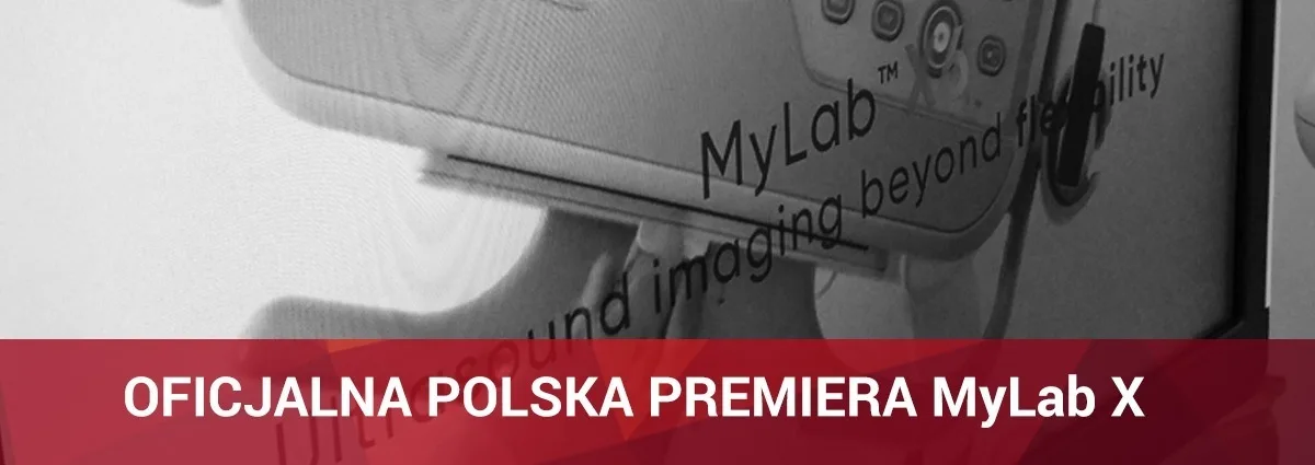 Aparaty usg MyLab serii X – nowość w ofercie Esaote i KOSMED