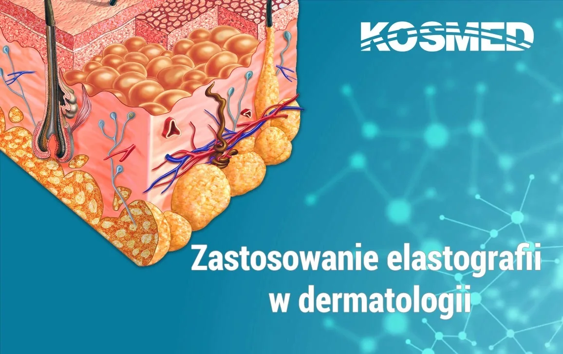 Zastosowanie elastografii w dermatologii