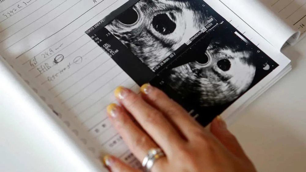 Ultrasonograf – dlaczego ultrasonograf jest jednym z najważniejszych sprzętów medycznych w każdej klinice?